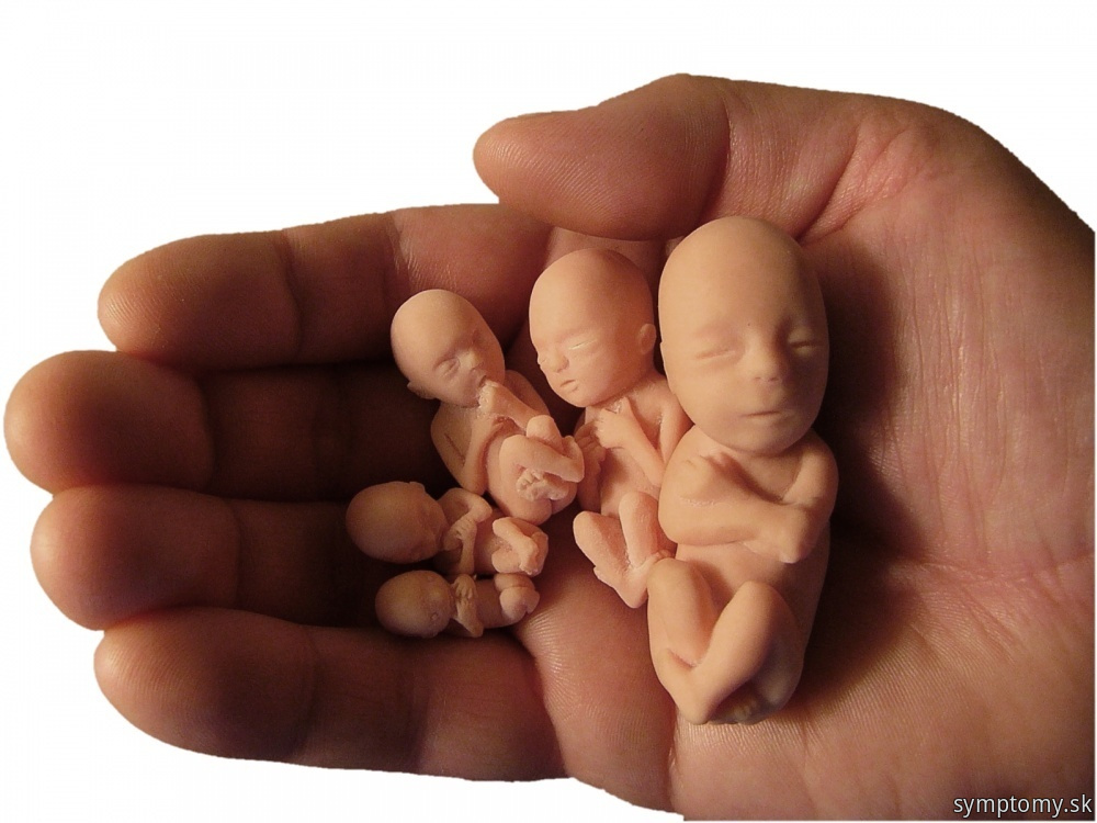 Etapy-vyvoja-embrya-a-plodu