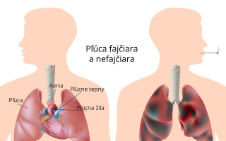 Chronická obštrukčná choroba pľúc