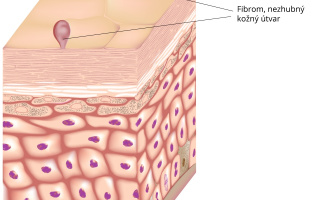 Fibrom