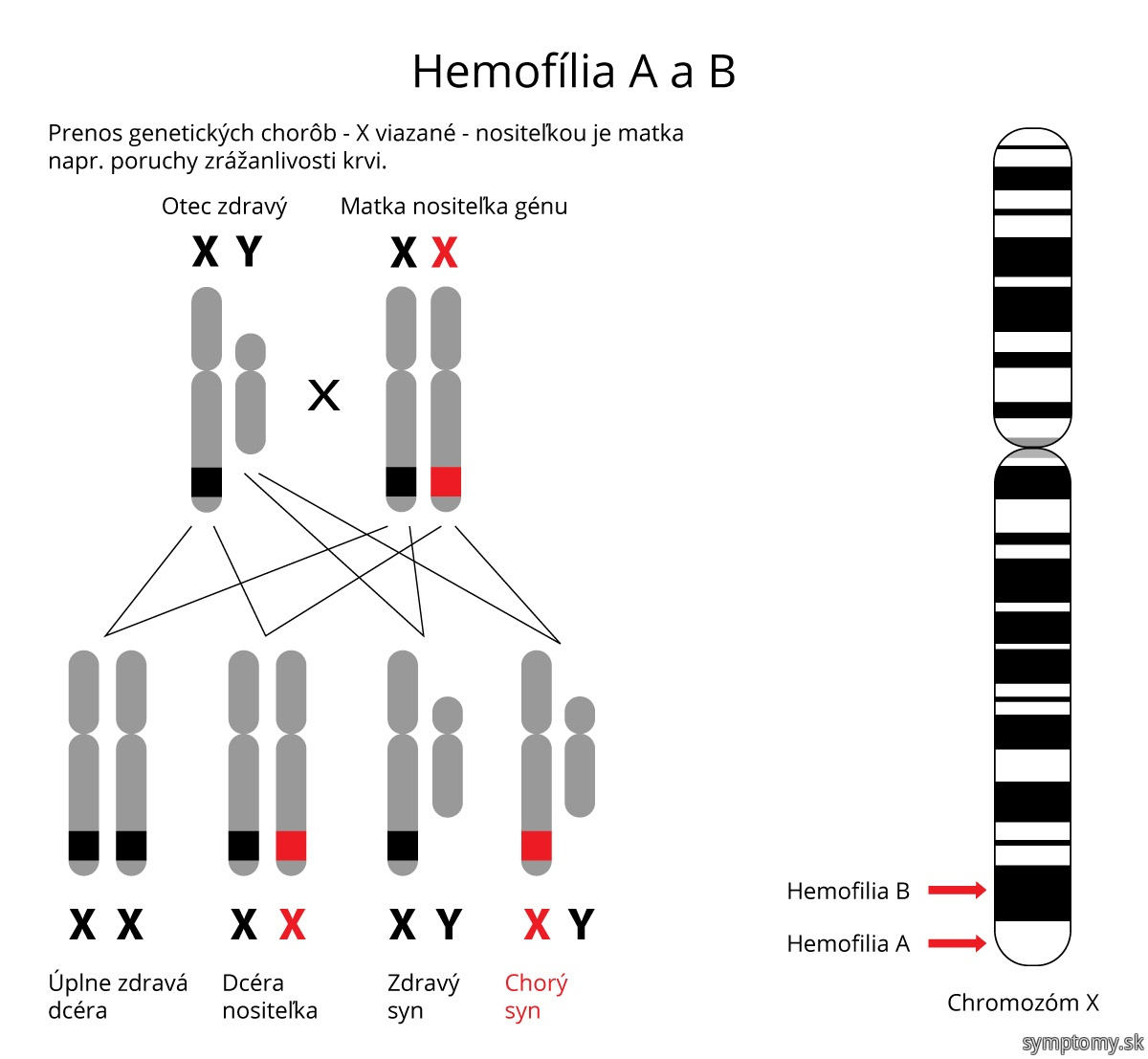 Hemofília A a B