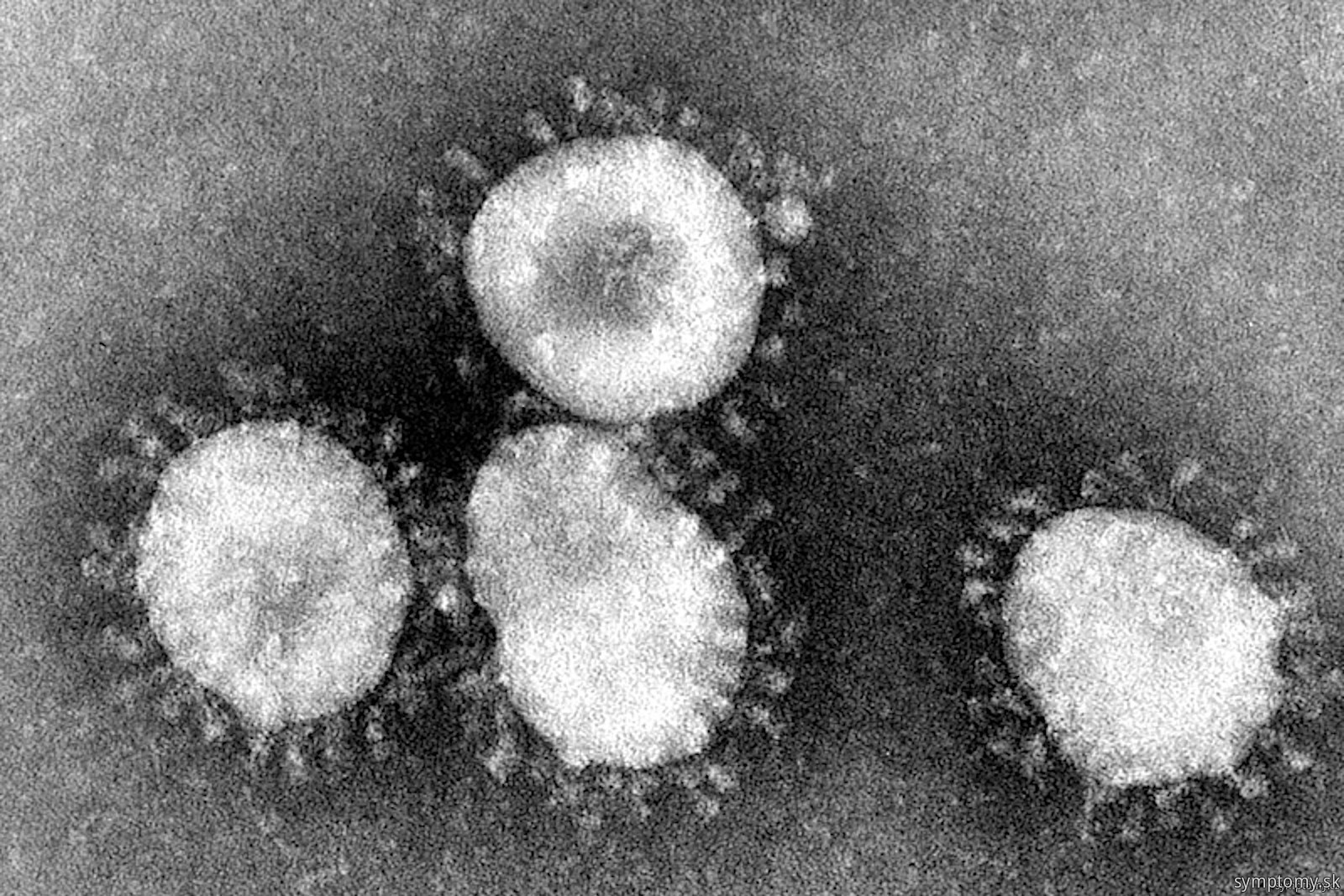 Koronavirúsy