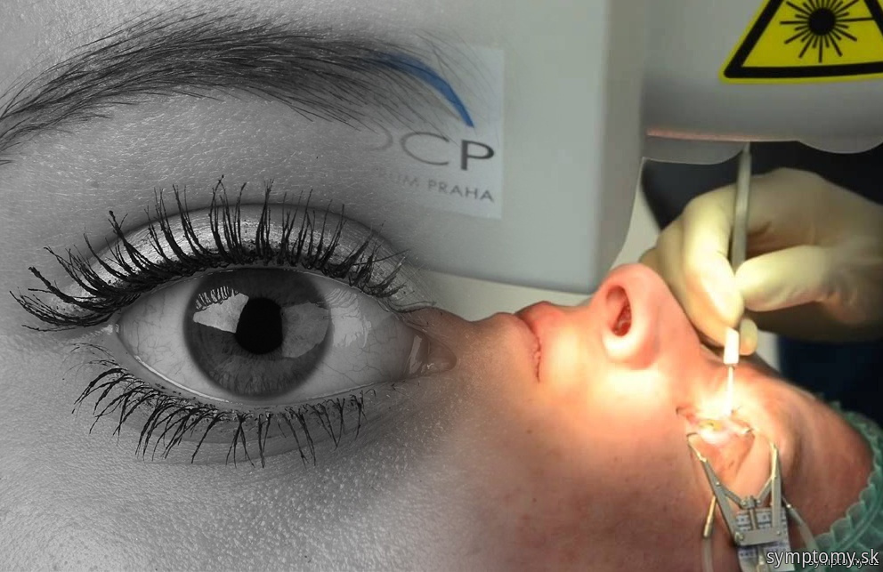 Laserová operácia oka