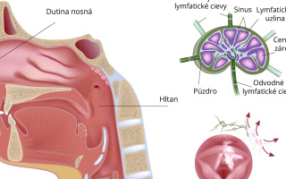 Non-Hodgkinov lymfóm