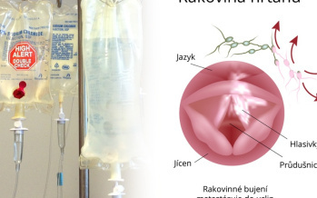 Lieky na rakovinu a antihistaminiká