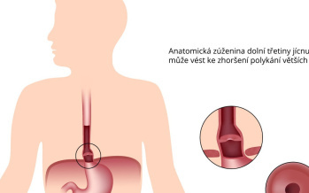Schatzkiho prstenec