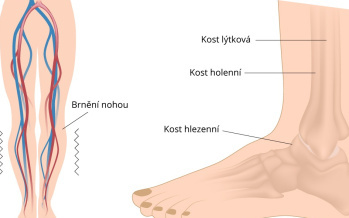 Syndróm nepokojných nôh