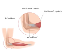 Tenisový lakeť