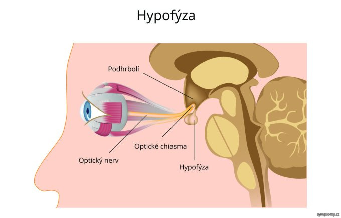 Adenóm hypofýzy 