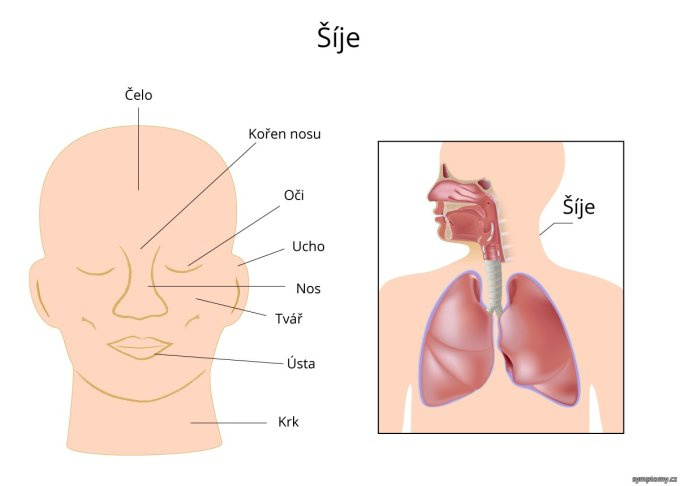 Šije