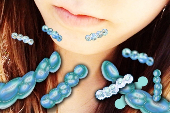 Streptococcus a angina