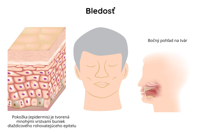 Bledosť