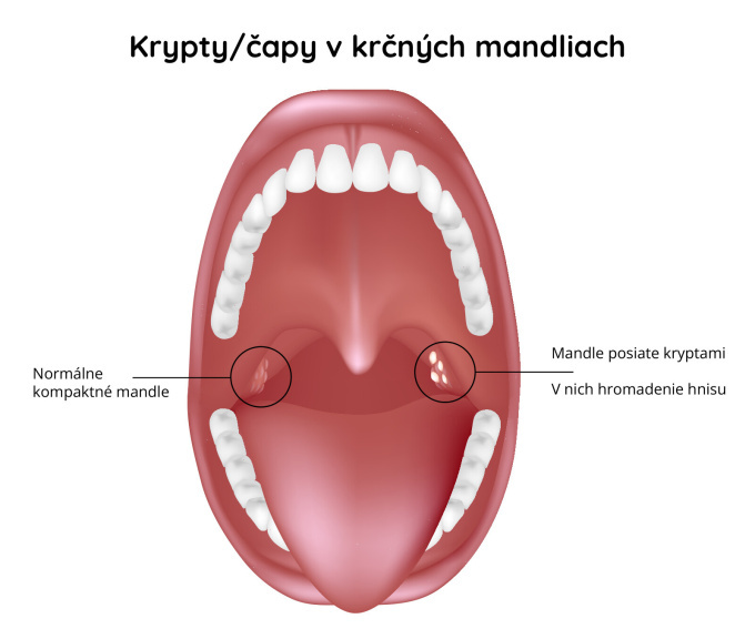 Čapy na mandliach 