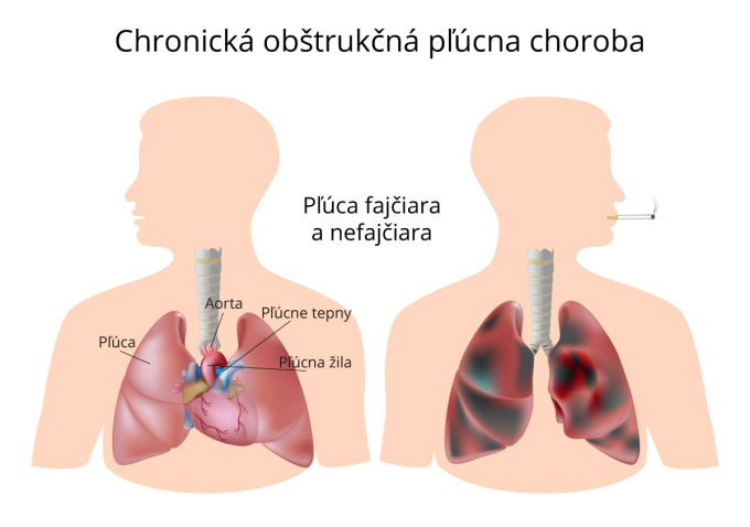 Pľúca fajčiara a nefajčiara