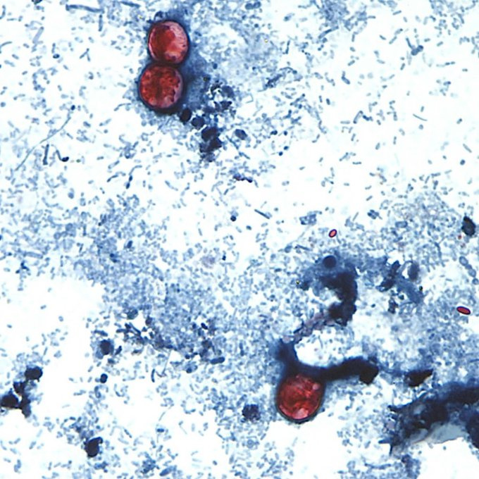 Cyklosporóza