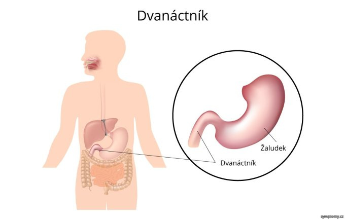 Dvanástnik