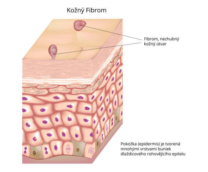 Fibrom