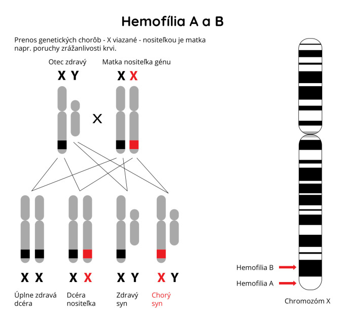 Hemofília A a B