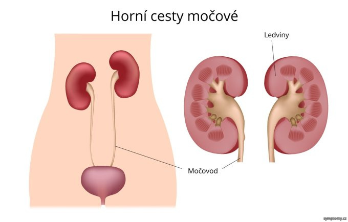 Horné cesty močové