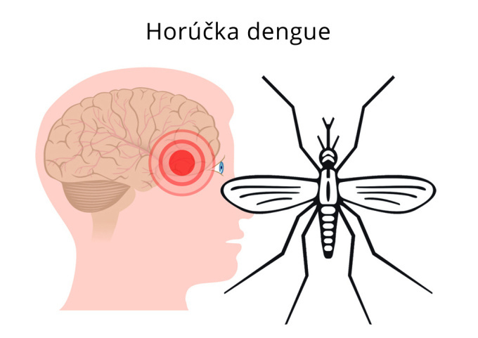 Horúcka dengue