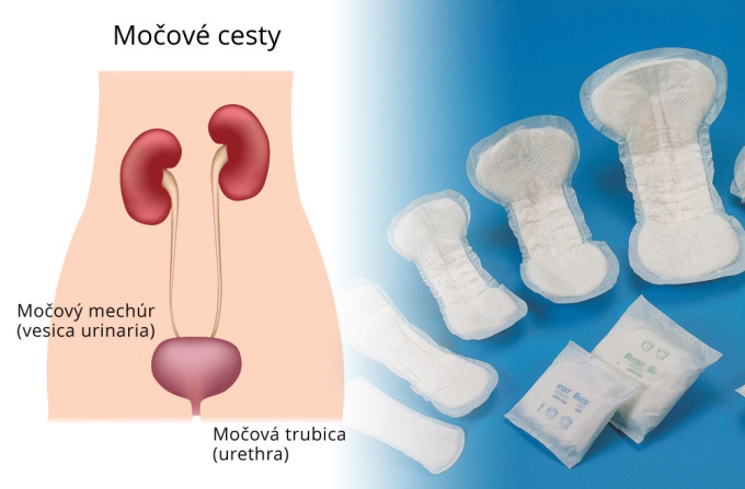 Inkontinencia samovoľnom-unik moci