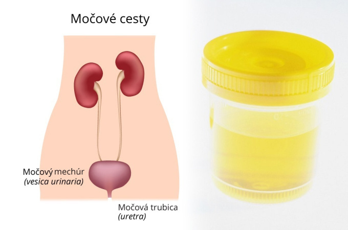Krev v moci