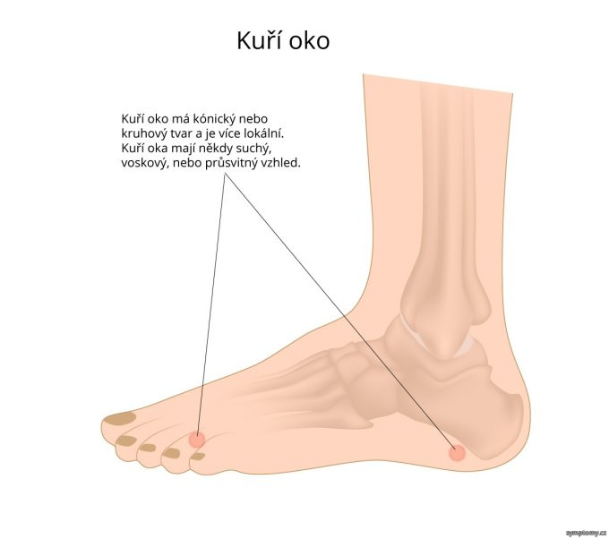 Kurie oko