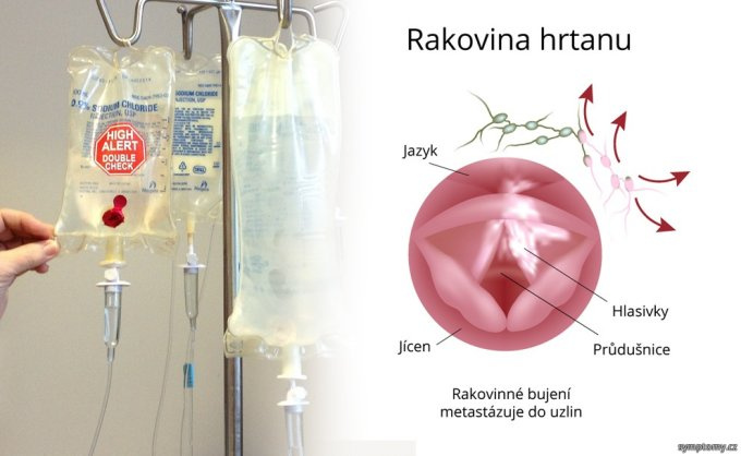 Lieky na rakovinu a antihistaminiká