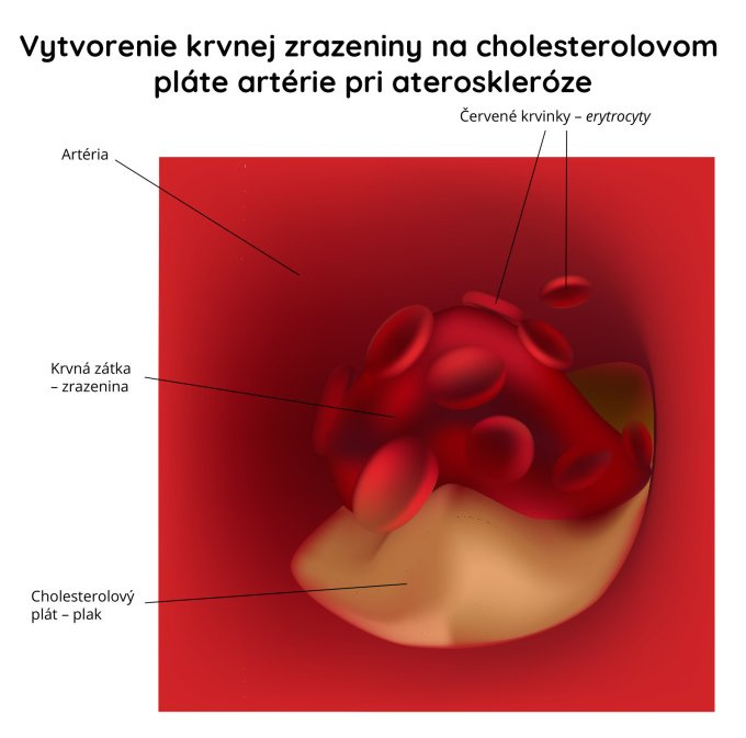 Lieky na zrážanie krvi
