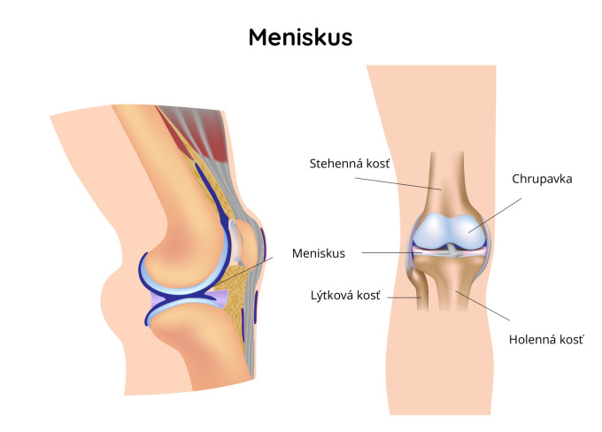 Meniskus