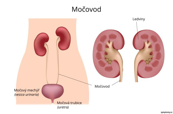 Močovod