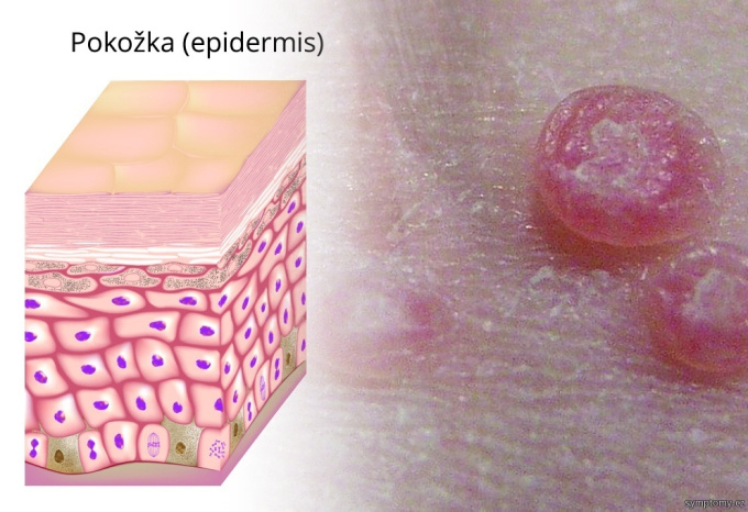 Moluská