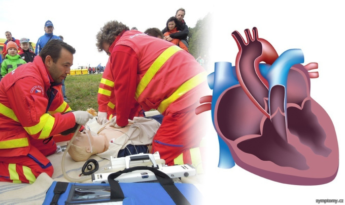 Resuscitácia