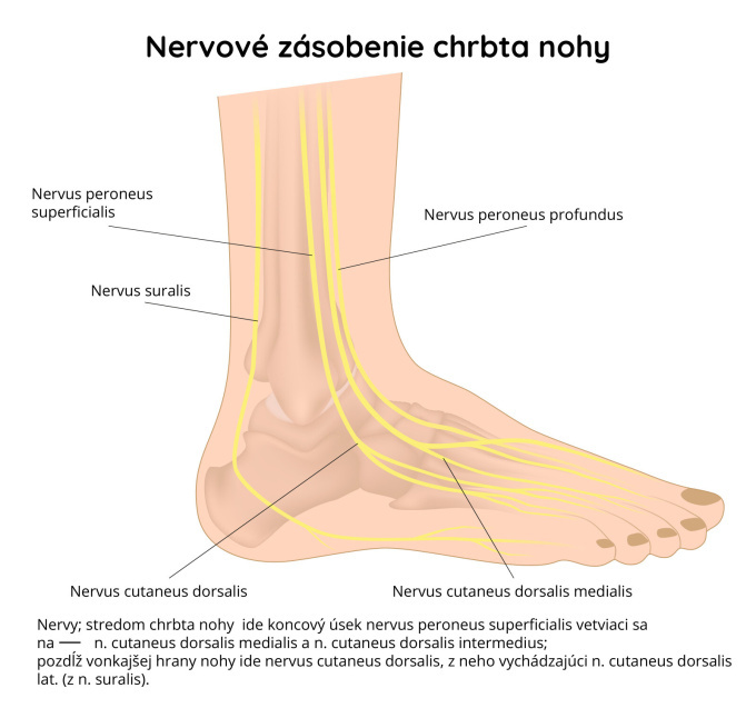 Neuropatia