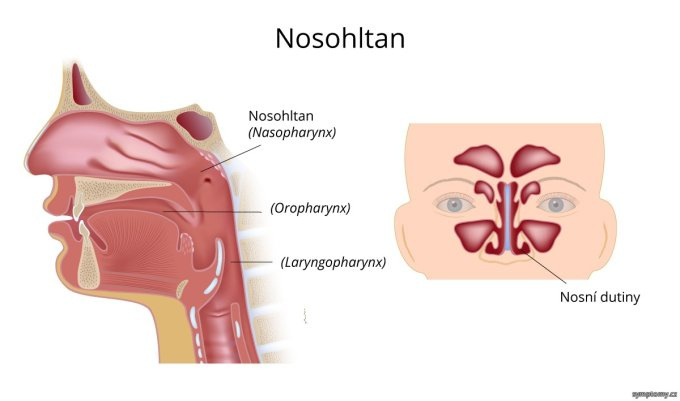 Nosohltan