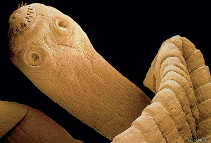 Pásomnica dlhá, taenia saginata