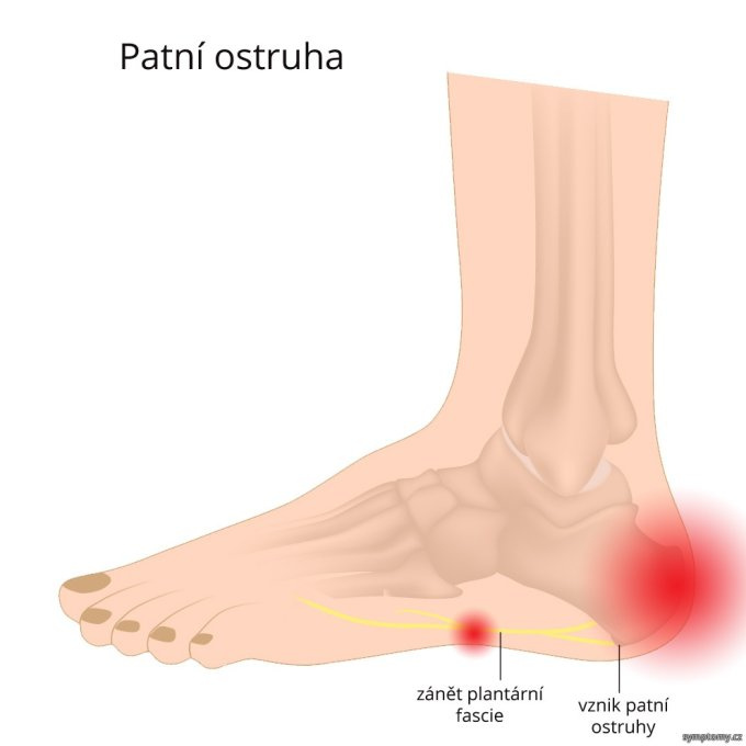 Pätná ostroha