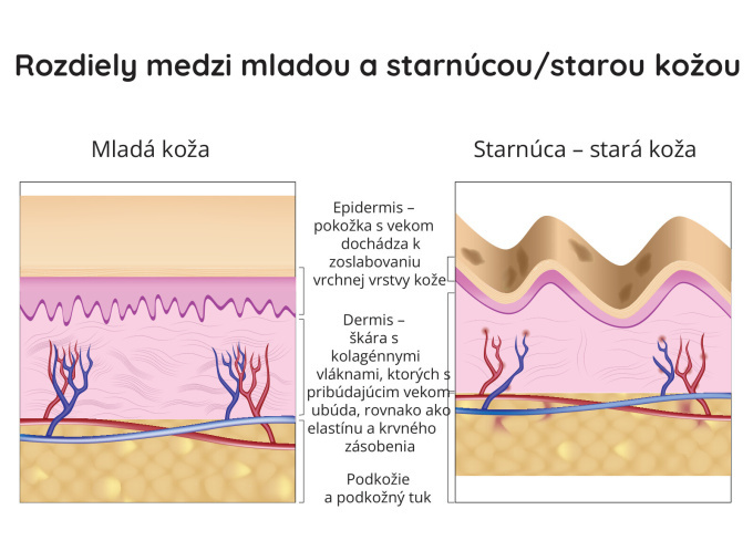 Rozdiely medzi mladou a starou kožou