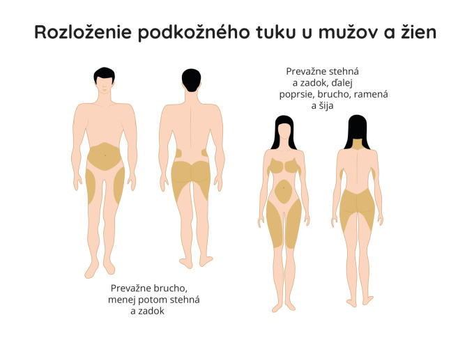 Rozdiely v rozložení podkožného tuku u mužov a žien