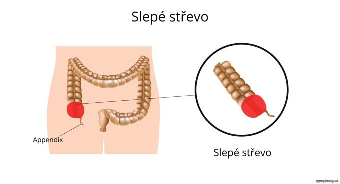 Slepé črevo