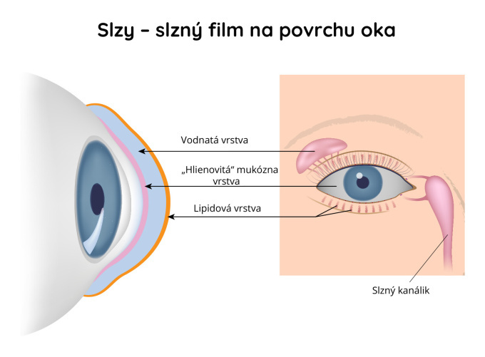 Syndróm suchého oka