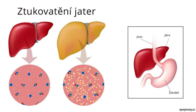 Zväčšenie pečene