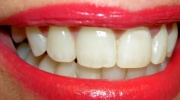 Citlivosť zubov