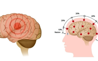 Prvá pomoc pri epileptickom záchvate