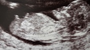 Tretí mesiac tehotenstva