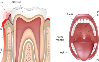 Zápal ďasna (gingivitída)