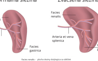 Zväčšenie sleziny